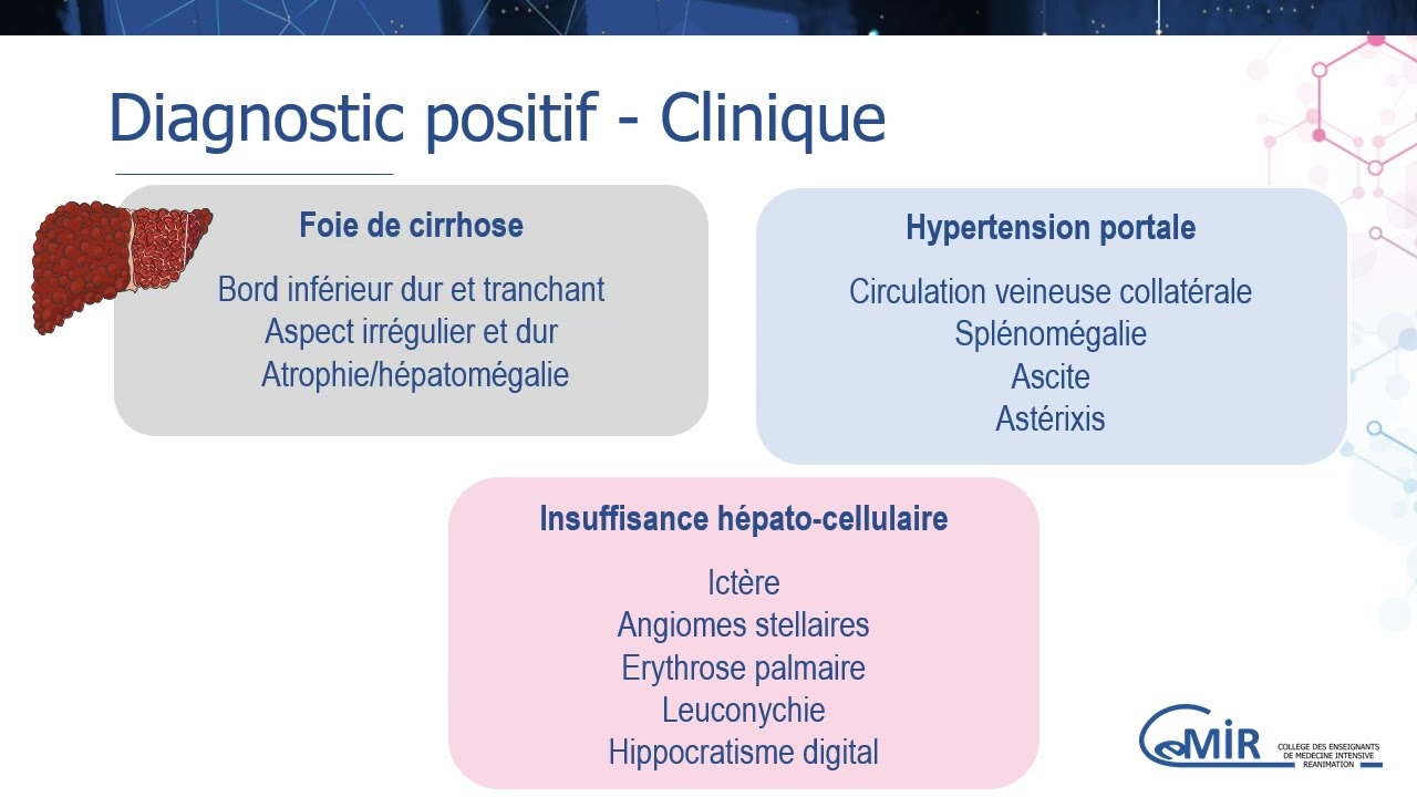 8 54 1 Décompensation de cirrhose