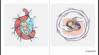 Can pudendal nerve stretch injury during prolonged labour cause persistent ... | WHC Clinical FAQ