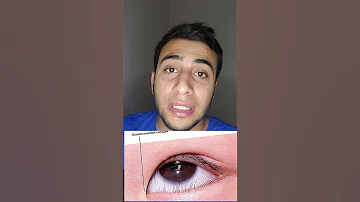 سبب شكل عيون الصينيين فراغ 28 