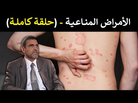 الأمراض المناعية لماذا يهاجم الجسم نفسه ما علاقتها بالتغذية د محمد الفايد برنامج نخل ورمان