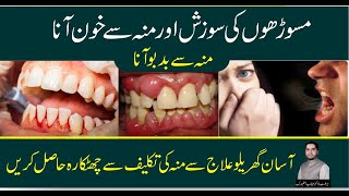 Teeth Bleeding, Gums Swelling, Bad Breath Problem Solution At Home | By: Herbalist Mehtab Aslam