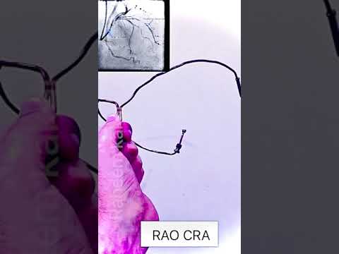 ANGIOGRAPHIC VEIWS OF