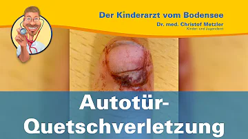 Wie lange dauert eine Fingerquetschung?