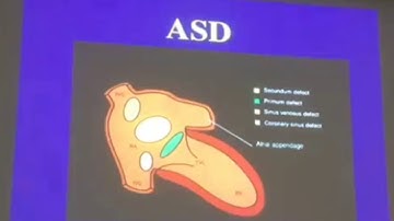 Siêu âm tim trong bệnh thông liên nhĩ (PGS. TS. Trương Quang Bình)