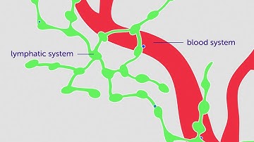 What is Secondary Cancer? | Cancer Research UK