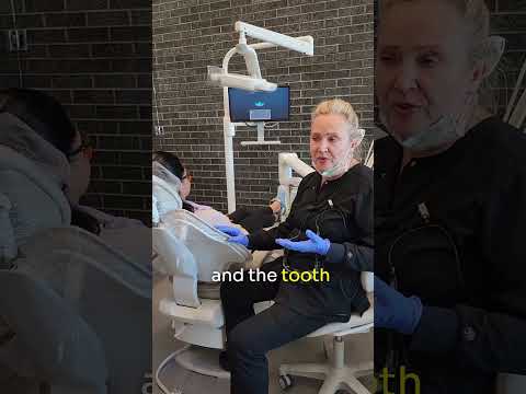 ❌ Why we don’t like Root Canals.