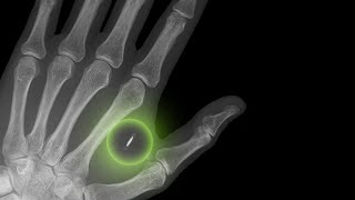Impfchips & (RF)ID-(Chip)Implantate: In Zukunft etwas ganz Normales!
► Lets Play and Talk HAUPTKANAL: https://goo.gl/FuXoYt
► Lets Play and Talk GAMING: https://goo.gl/SALrcy
► Lets Play and Talk LIVE: https://goo.gl/cTnHKp
Meine anderen Kanäle:
► Discord: https://discord.gg/jVRU8GU
► Smashcast: https://goo.gl/J4D3gO
► Twitch: https://shorturl.at/dyC56
► Mixer: https://goo.gl/NSaEZM Impfchips & (RF)ID-(Chip)Implantate: In Zukunft etwas ganz Normales!