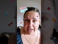 Skintox spray