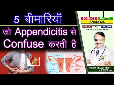 5 Appendicitis Confuse || What Other Conditions Can Mimic Appendicitis