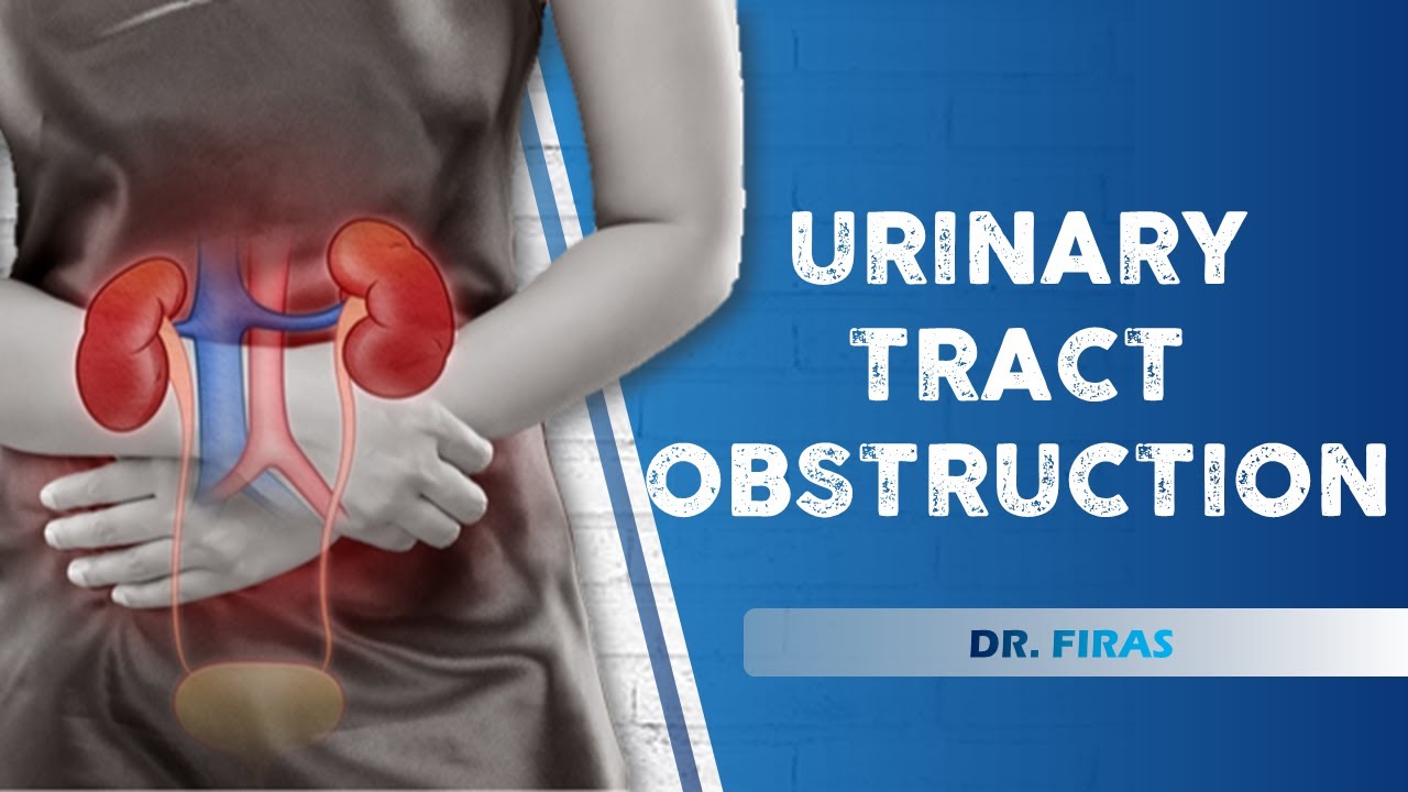 Urinary tract obstruction Dr. Firas Lecture 2 YouTube