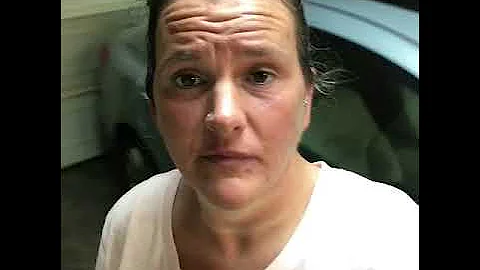 Partial Dentures*IS IT WORTH IT