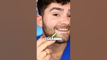 Best Way to Clean Braces !?