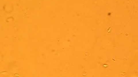 Living Cell Trapping by Optical Tweezers