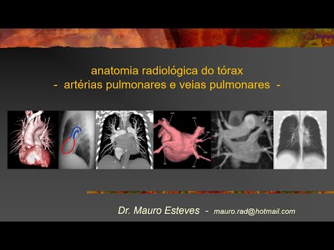 Vídeo: Diferença Entre Artéria Pulmonar E Veia Pulmonar