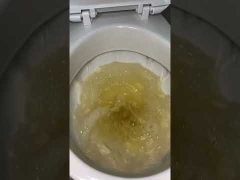 Coloca 1 barra