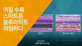 어릴 수록 스마트폰 블루라이트 위험하다 - (2016.2.17_571회 방송)_스마트폰 건강주의보