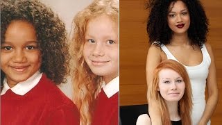 Twins With Completely Different Skin Colors Turns Heads In The UK