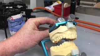 Occlusion: Case Study 8