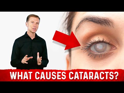 What Causes Cataracts?