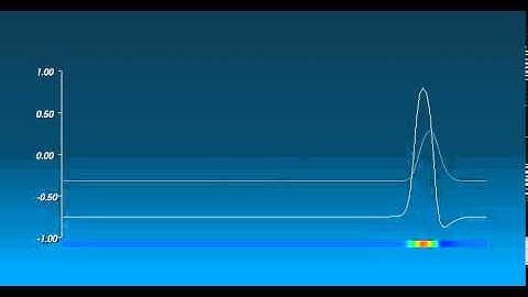 Action Potential 2 - William Edward Hahn