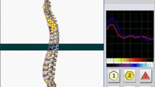 Metavital Oberon Hunter Version 2