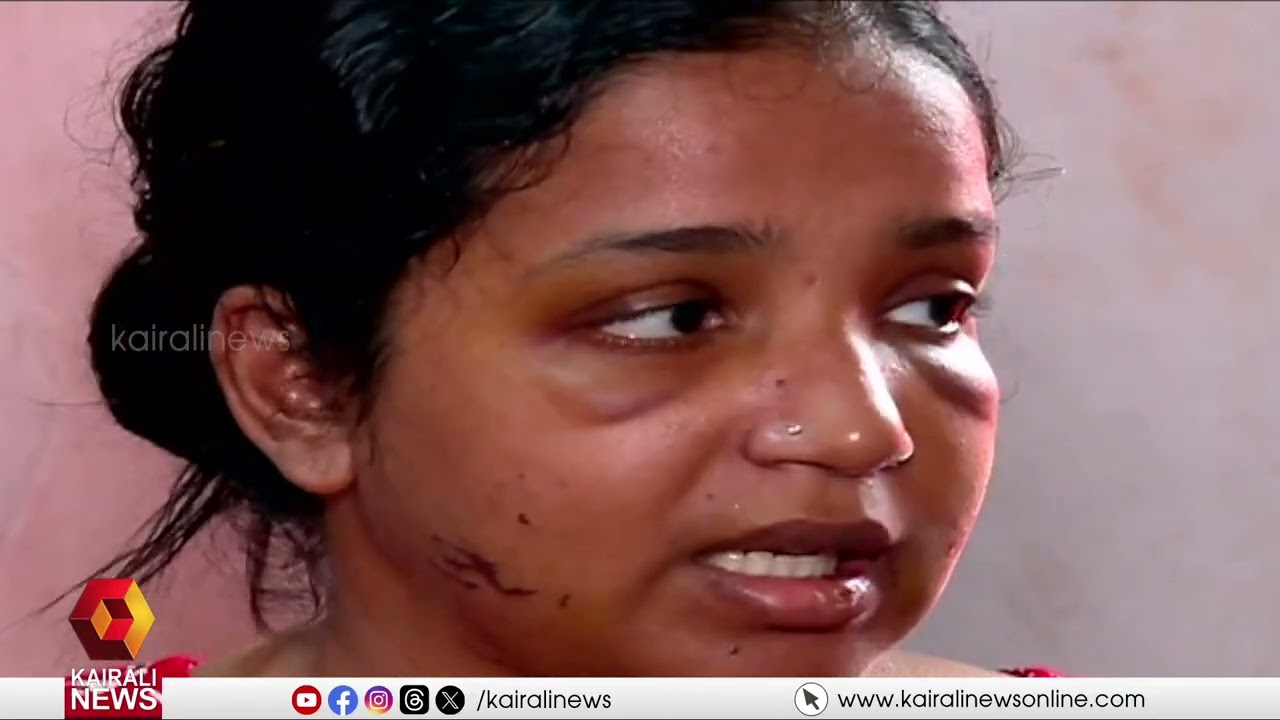 'കാരണങ്ങള്‍ ഒന്നുമില്ലാതെയാണ് പലപ്പോഴും അടിക്കുന്നത്'; കോട്ടയത്ത് യുവതിയെ തല്ലിച്ചതച്ച് ഭര്‍ത്താവ്