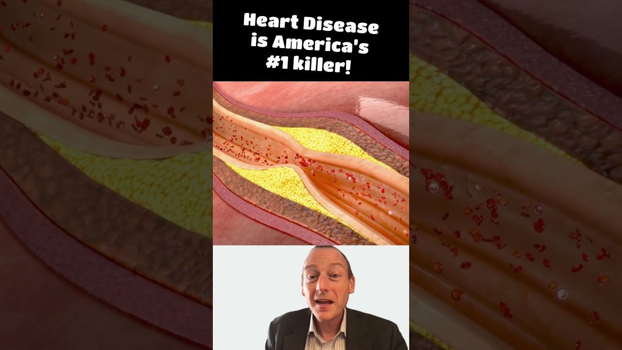 Beans Beans good for your heart! Stop the farts! 