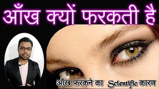 Eye twitching causes cure and treatment  ||   हमारी आखें क्यों फरकती है