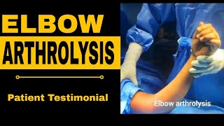 Elbow Arthrolysis Surgery Patient Testimonial