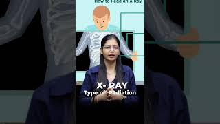 X-Ray क्या है ?🔬 X-ray खोज, सिद्धांत #xray #paramedical