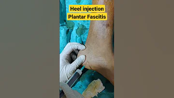 Heel Pain Injection Fast Immediate Relief Plantarfasciatis Heelpain Heelpaintreatment 