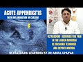 Ultrasound of acute appendicitis | appendicitis ultrasound | appendix ultrasound normal vs abnormal