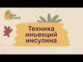 Лечение диабета. Техника инъекций инсулина