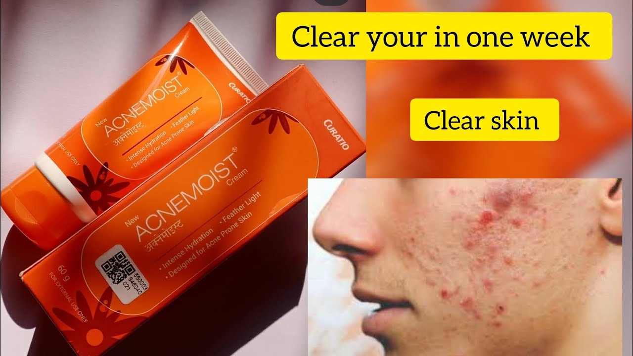 acnemoist moisturizer review tamil #pimple #acne #acnetreatment - YouTube