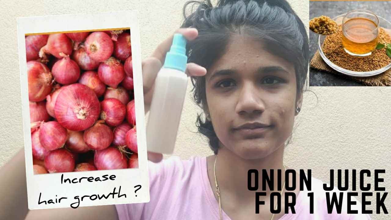 LET'S TRY ONION JUICE FOR 1 WEEK , MODERN _PONU IS IT INCREASES HAIR