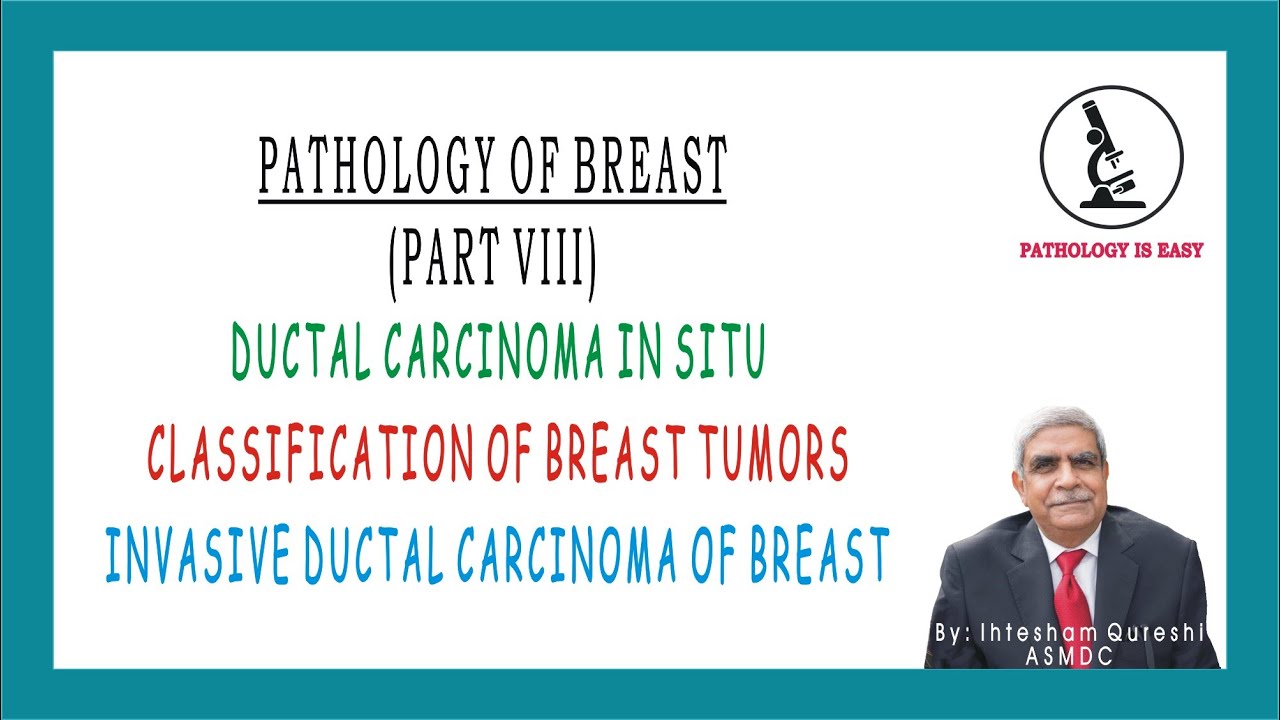 DUCTAL CARCINOMA IN SITU | CLASSIFICATION OF BREAST TUMOR | INVASIVE ...