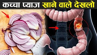 कच्चा प्याज़ खाते हो तो एक बार जरूर देखना ! Health Benefits And Side Effects Of Onion