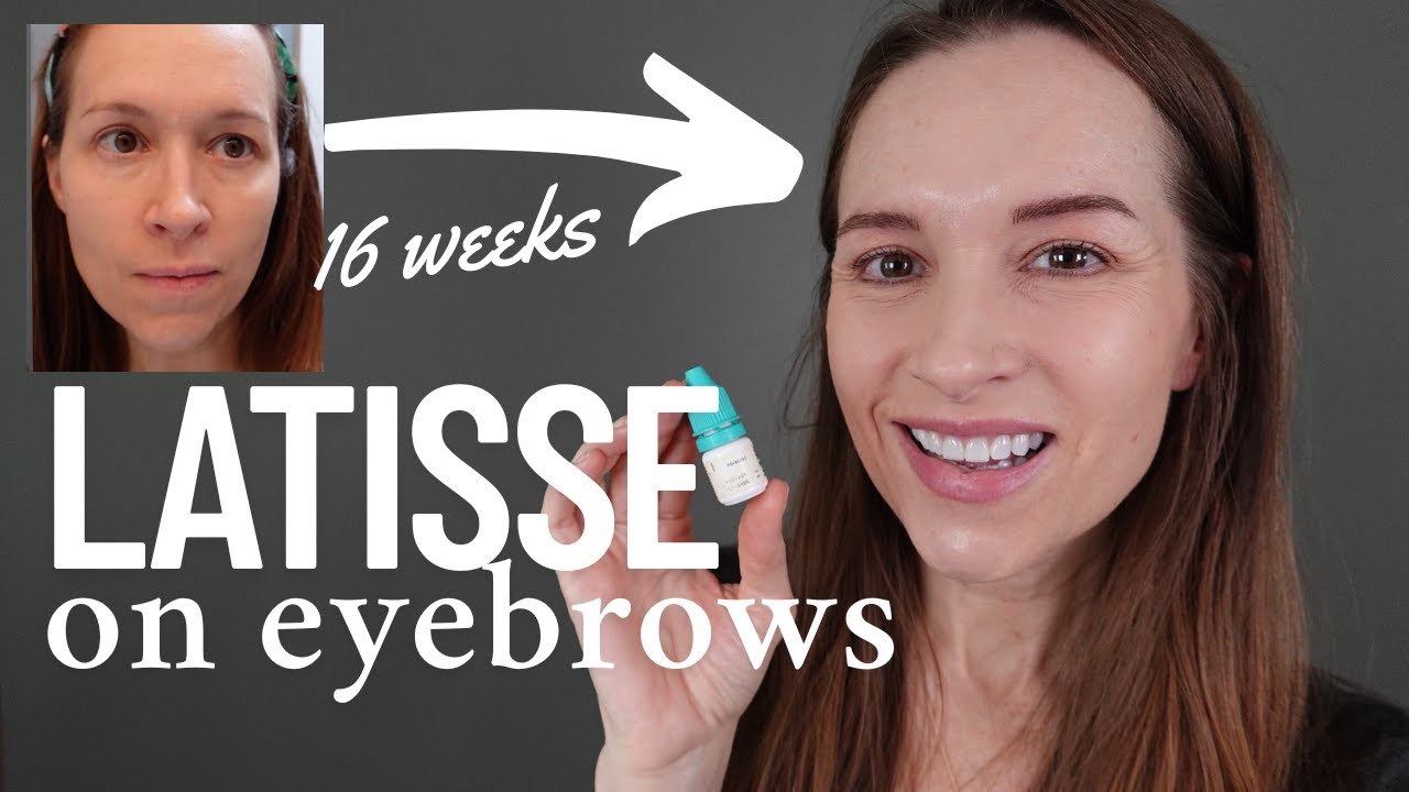 How to Thicken Your Overplucked Eyebrows with Bimatoprost (generic Latisse)// NOT AN AI VIDEO