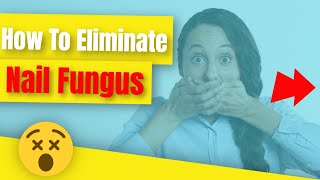 How To Eliminate Toenail Fungus||Nail Fungus Revealed By Dr. Cathy Robbins(Best ebook)