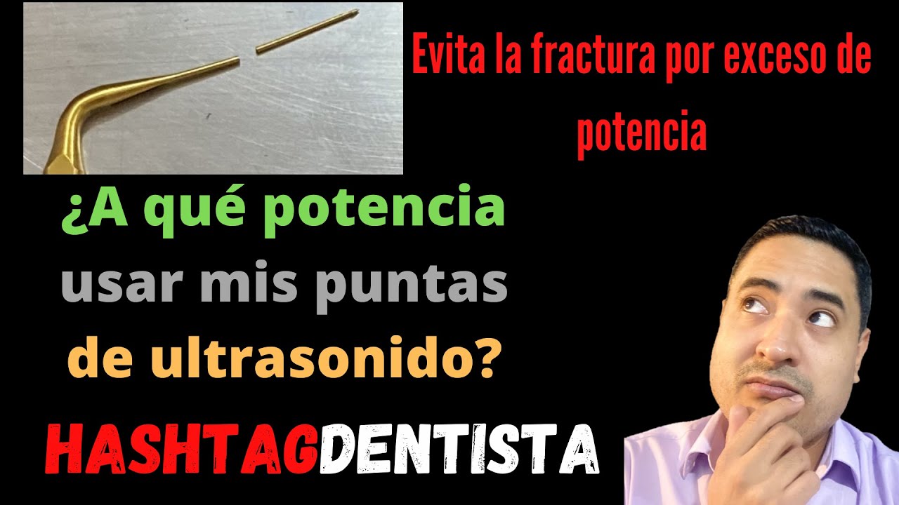 ¿A qué potencia usar las puntas de ultrasonido? - Endodoncia