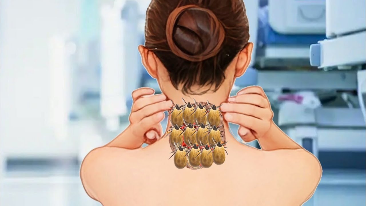 ASMR removal dog tick from woman nack । 2d animation। asmr animation ...