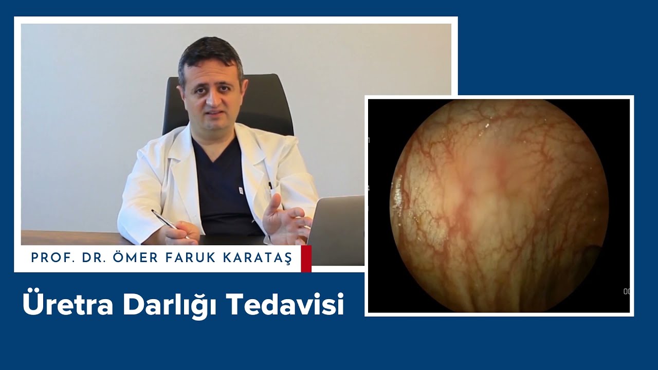 Üretra Darlığı Tedavisi - Prof. Dr. Ömer Faruk Karataş