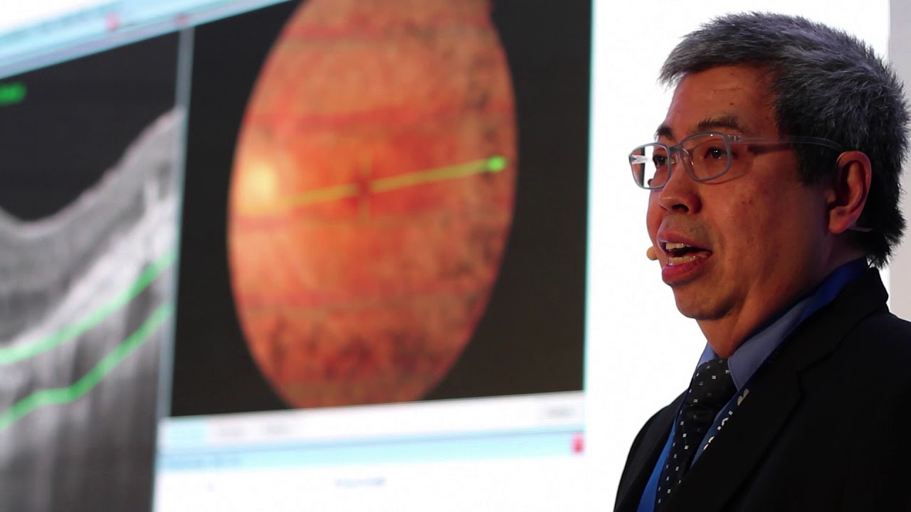 3rd International Swept Source OCT & Angiography Conference Promo