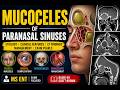 Mucoceles of Paranasal Sinuses | Etiology, Clinical Features, CT Findings & Management | MS ENT