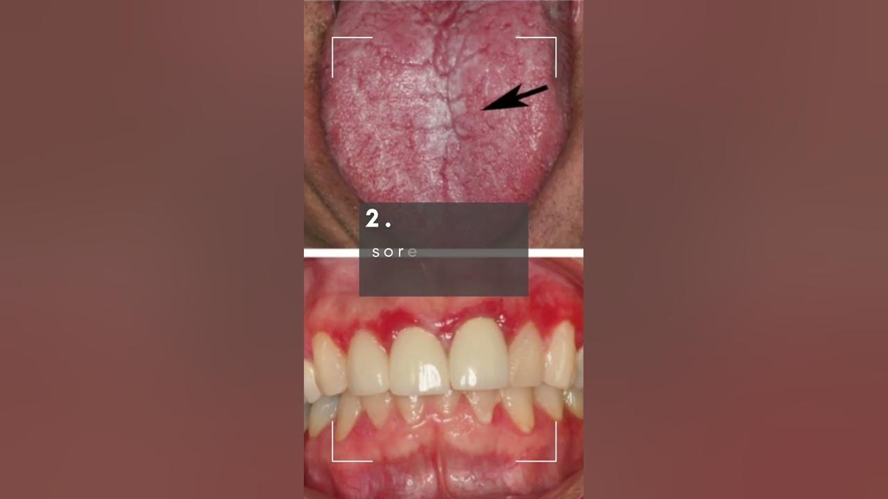 Can A Dentist Tell If You Have Sepsis