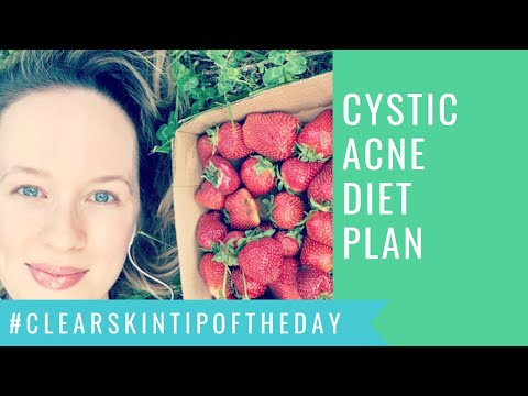 Cystic Acne Diet Plan - Clear Acne Fast!