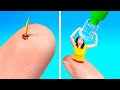 OH NOO! 😬 IF SPLINTER WERE A PERSON! | LIFE-SAVING Hacks and Relatable Problems For Clumsy People