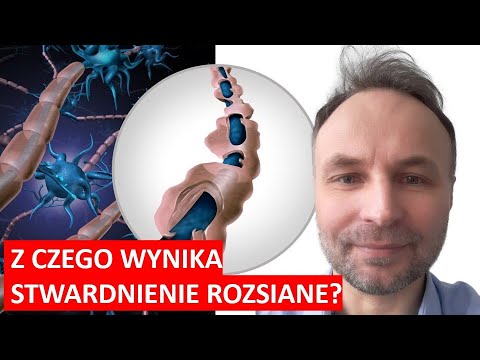 Wideo: Czy Reszta jest beneficjentem?