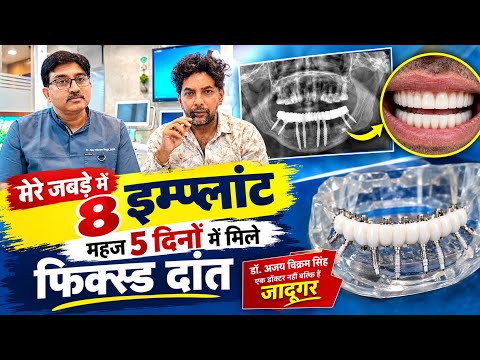 मेरे जबड़े में 8 इम्प्लांट, महज 5 दिनों में मिले फिक्स्ड दांत