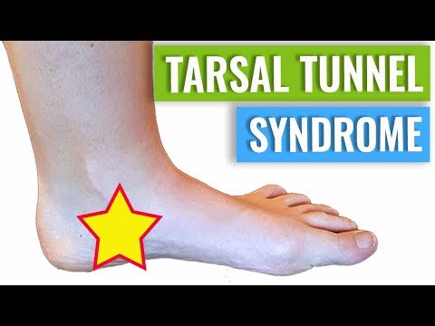 Tarsal Tunnel Syndrome Treatment & Diagnosis